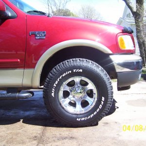 Before the Body Lift (Front)