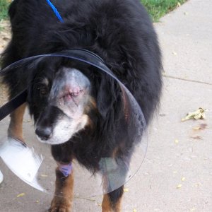 Heather_Post_Surgery
