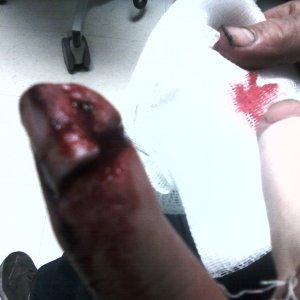 finger carnage - before 1