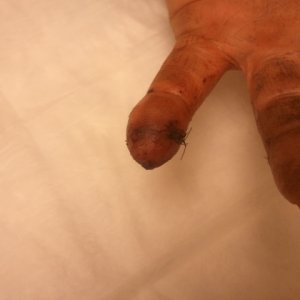 finger carnage - after 2