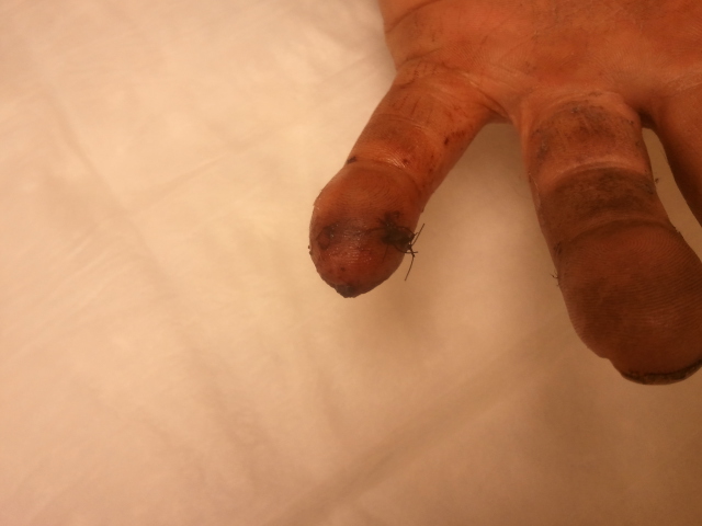finger carnage - after 2