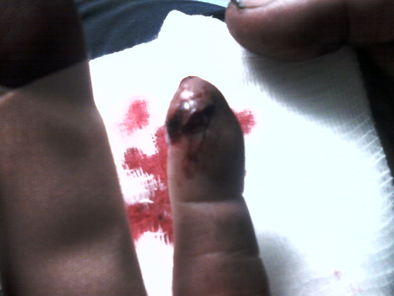finger carnage - before 2