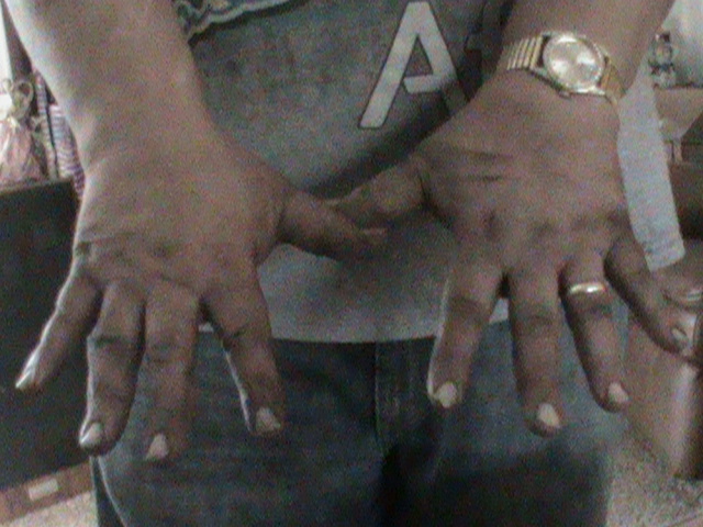 no cuts or scrapes