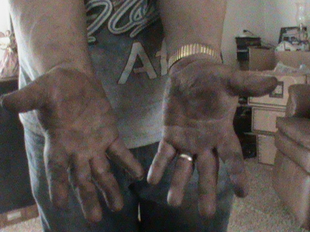 no cuts or scrapes